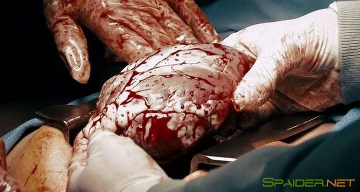 Адреналин: Высокое напряжение / Crank: High Voltage (2009) BDRip | Лицензия 5 Адреналин: Высокое напряжение / Crank: High Voltage (2009) BDRip | Лицензия 5